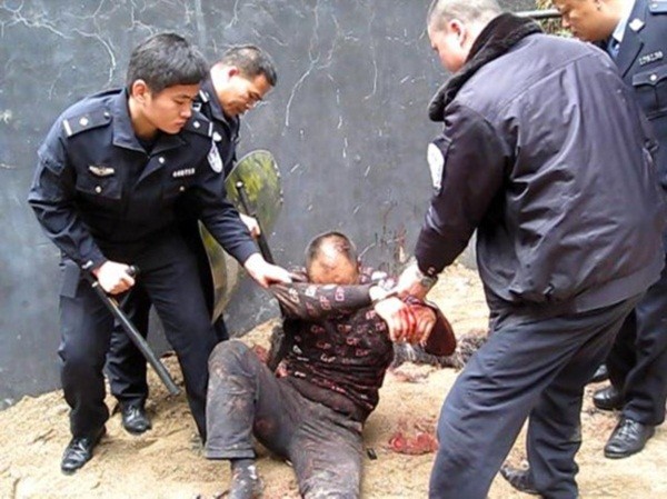 Thanh[-]niên[-]cắn[-]cổ...[-]hút[-]máu[-]đà[-]điểu[-]4